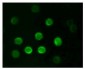 CD20 Antibody