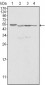 Calreticulin Antibody