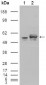 Calreticulin Antibody