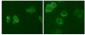 Tyro3 Antibody