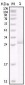 ERBB2 Antibody