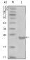 CD10 Antibody