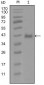 AR Antibody