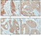 Cytokeratin 18 Antibody