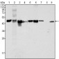 Cytokeratin 18 Antibody