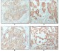 Cytokeratin 8 Antibody