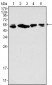 Cytokeratin 8 Antibody