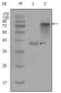 Cytokeratin 19 Antibody