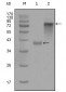 Cytokeratin 19 Antibody