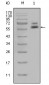 Cytokeratin 5 Antibody