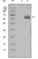 DKK1 Antibody