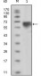 TYRO3 Antibody