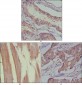 MUSK Antibody
