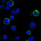 ROR1 Antibody