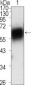 ROR1 Antibody