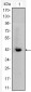 CTNNB1 Antibody