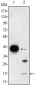 FABP2 Antibody