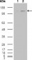 ABL2 Antibody