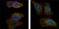 AKT2 Antibody