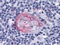 AKT2 Antibody