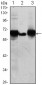 ALPP Antibody