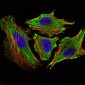 STAT6 Antibody