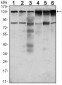 PTK7 Antibody