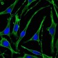 PTH1R Antibody