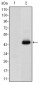 CEA Antibody