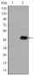 CEA Antibody