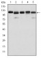 BMPR2 Antibody