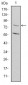 MTHFR Antibody