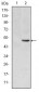 MTHFR Antibody