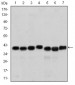 SMN1 Antibody