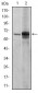 FYN Antibody