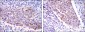 MMP1 Antibody