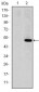 MMP1 Antibody