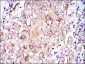 PRK2 Antibody