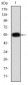 MMP9 Antibody