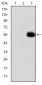 MMP9 Antibody