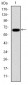 PSMB8 Antibody