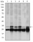 PSMB8 Antibody