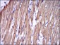 TNNI2 Antibody