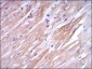 TNNI2 Antibody