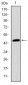 TNNI2 Antibody