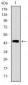 TNNI2 Antibody