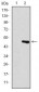 TNNI2 Antibody