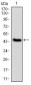 IL1B Antibody