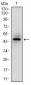 MSH6 Antibody