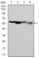 G6PD Antibody